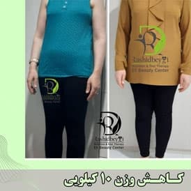 نتیجه رژیم شبنم عطایی