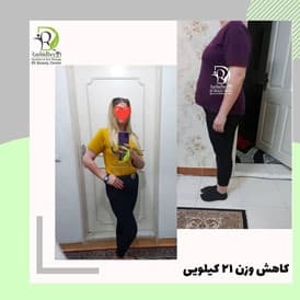 نتیجه رژیم شیوا قاسمی