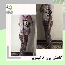 نتیجه رژیم ندا مرادی