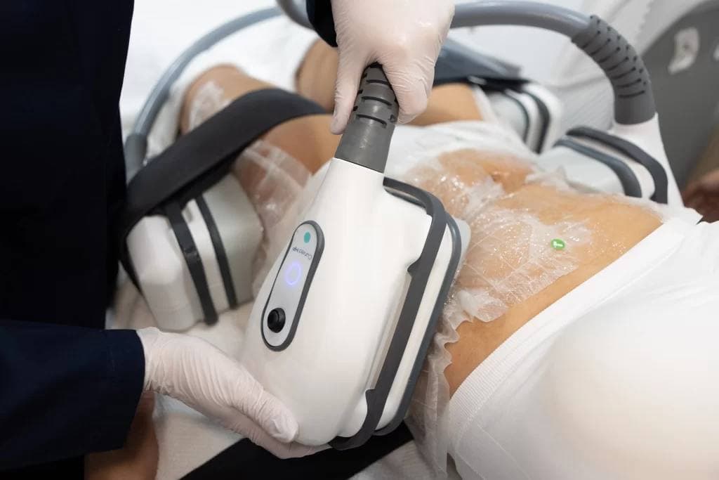 تصویر دستگاه CoolTech در کلینیک